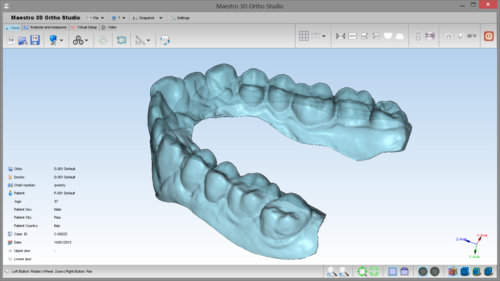Ортодонтски софтуер Maestro 3D Dental Studio